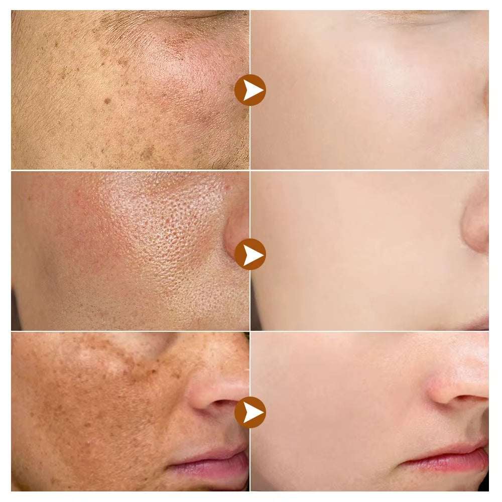 GlowFade™ Spotless Radiance Skin Brightening Serum